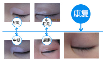 庆六一 青少年儿童白斑特别关爱行动