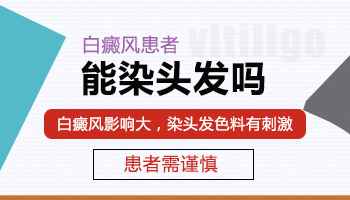 得了白癜风要少烫染头发，你知道吗?